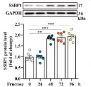 Western blot analysis of the protein level of SSBP1.jpg